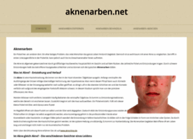 Aknenarben.net thumbnail