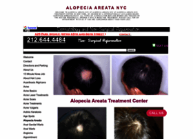 Alopeciaareatanyc.org thumbnail
