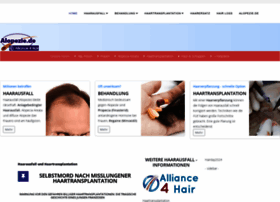 Alopezie.de thumbnail Alopezie.de thumbnail