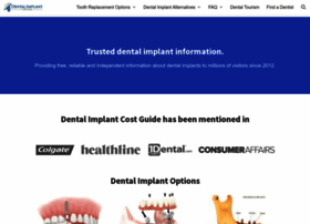 Dentalimplantcostguide.com thumbnail