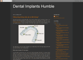 Dentalimplantshumble.com thumbnail