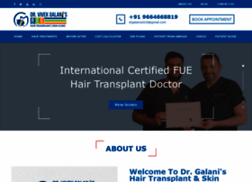 Drgalanishairtransplant.com thumbnail