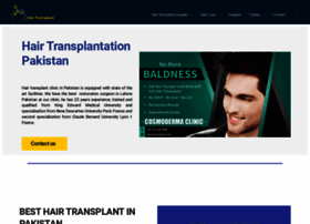 Hairtransplantationpakistan.com thumbnail
