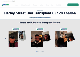 Harleystreethairtransplant.co.uk thumbnail