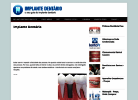 Implantedentarioprecos.com.br thumbnail