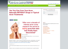 Natural-acne-treatments.com thumbnail