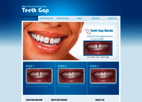 Teethgap.com thumbnail