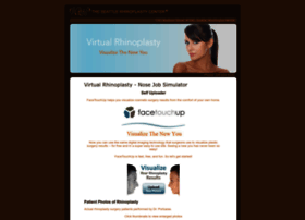 Virtual-rhinoplasty.com thumbnail