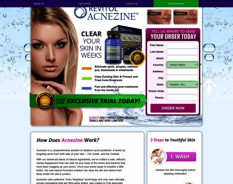 Acnezine.com thumbnail