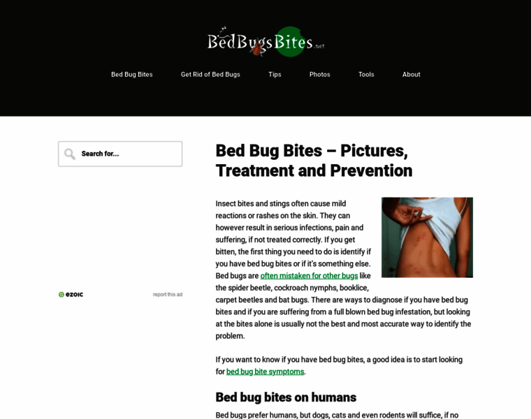 Bedbugsbites.net thumbnail