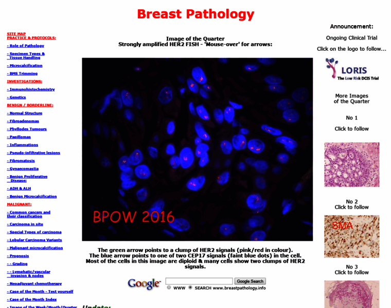 Breastpathology.info thumbnail