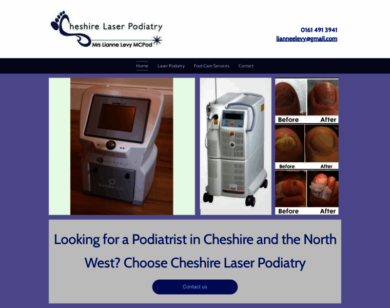 Cheshire-laser-podiatry.co.uk thumbnail
