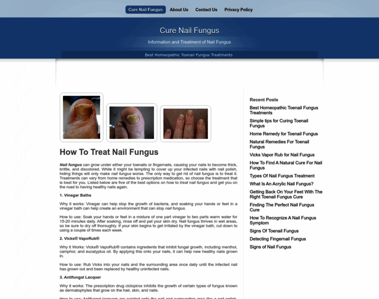 Cure-nail-fungus.com thumbnail
