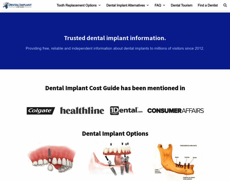 Dentalimplantcostguide.com thumbnail