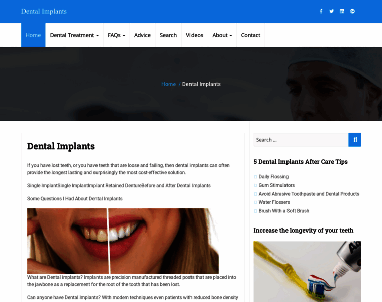 Dentalimplants-uk.co.uk thumbnail