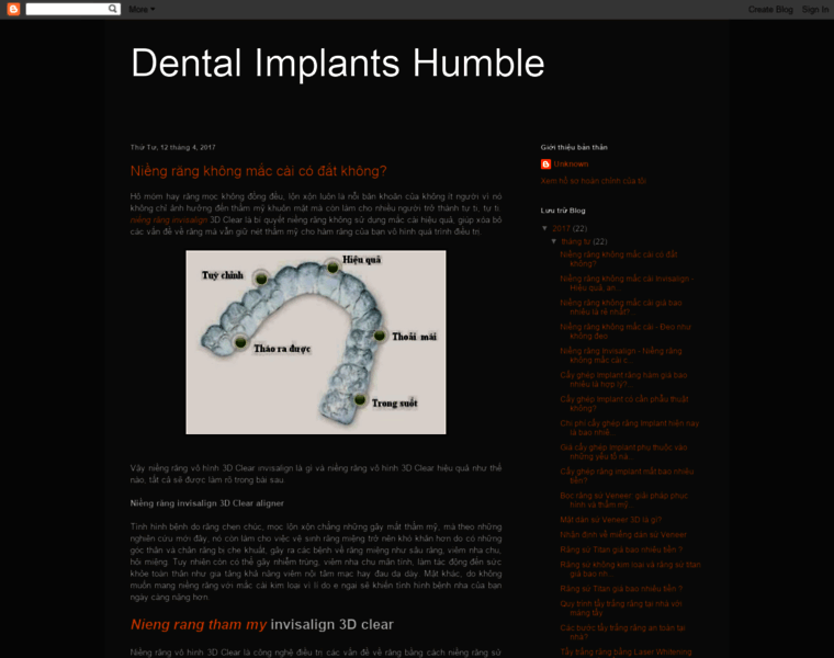 Dentalimplantshumble.com thumbnail