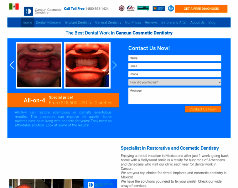 Dentalimplantsmexico.org thumbnail
