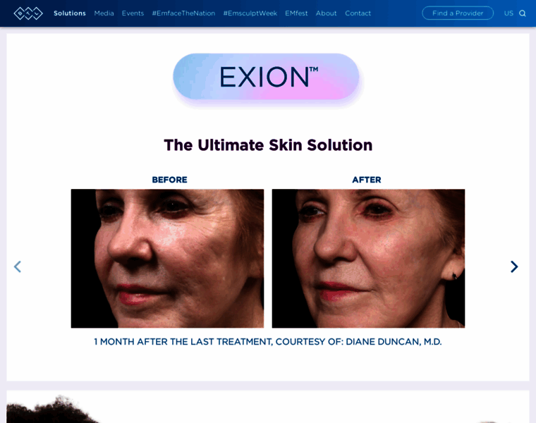 Exion.com thumbnail