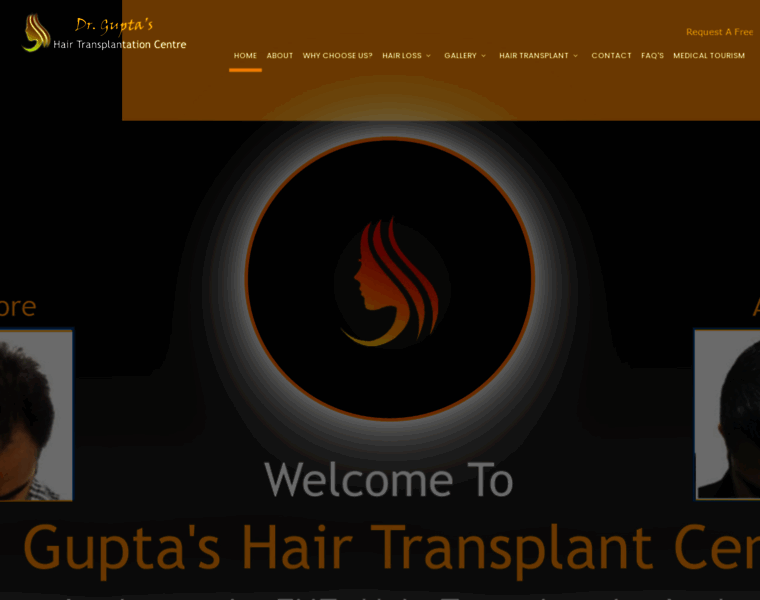 Hairtransplantinamritsar.com thumbnail