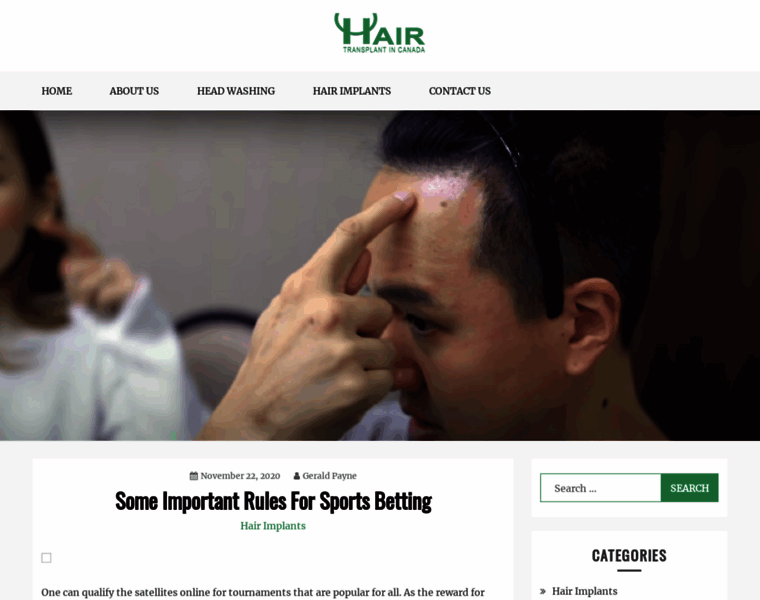 Hairtransplantincanada.com thumbnail