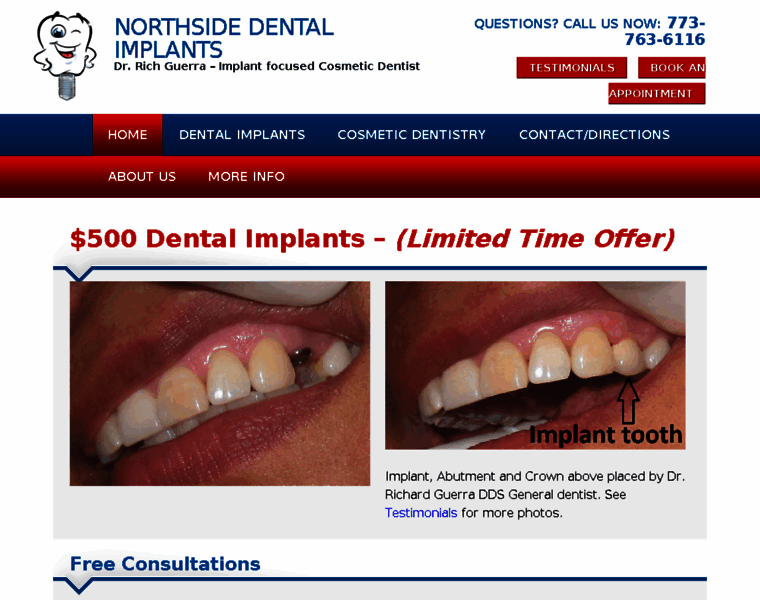 Implant500.com thumbnail