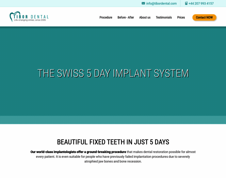 Implants-teeth-in-5days.com thumbnail