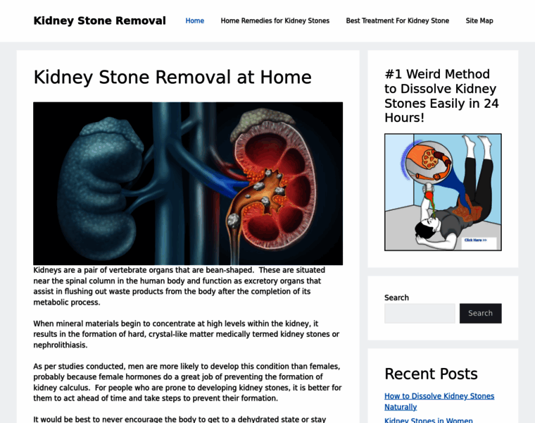Kidneystoneremovalathome.com thumbnail