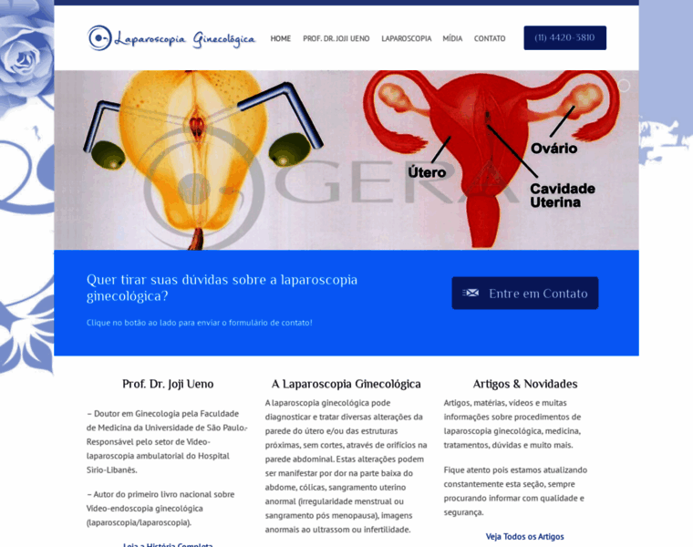 Laparoscopiaginecologica.net.br thumbnail
