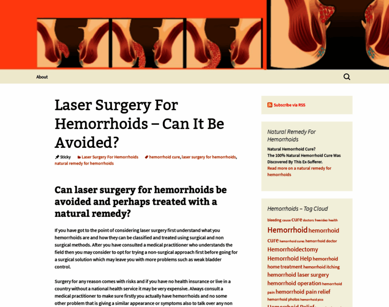 Lasersurgeryforhemorrhoids.com thumbnail