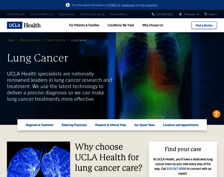 Lungcancer.ucla.edu thumbnail