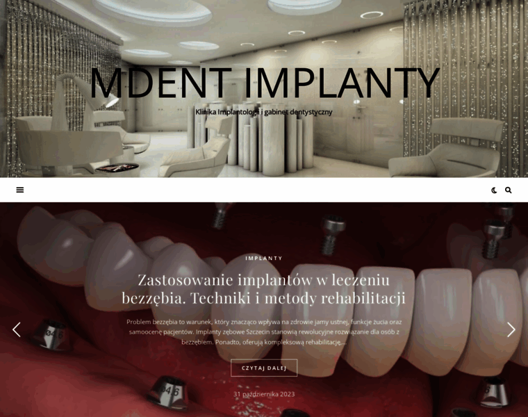 Mdent-implanty.pl thumbnail