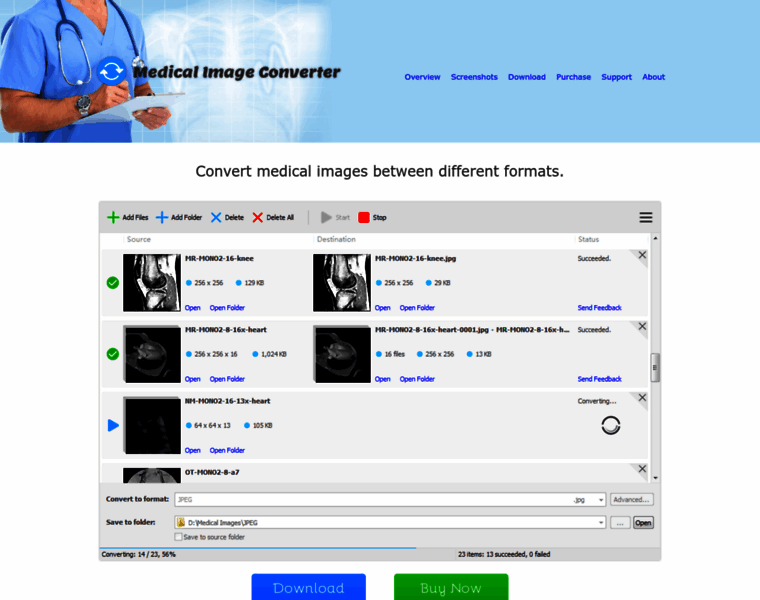 Medicalimageconverter.com thumbnail Medicalimageconverter.com thumbnail