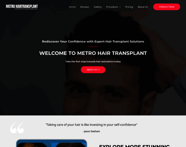 Metrohairtransplant.in thumbnail