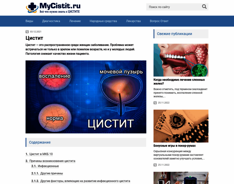 Mycistit.ru thumbnail