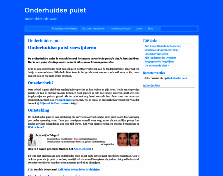Onderhuidsepuist.nl thumbnail