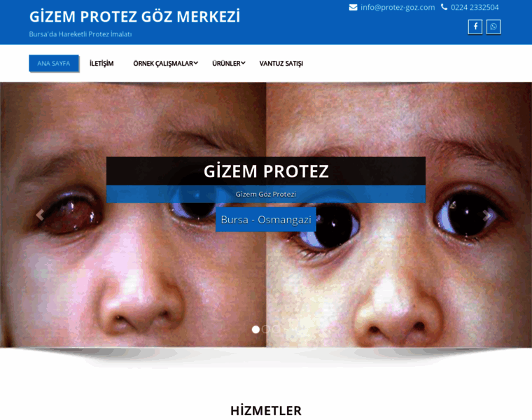 Protez-goz.com thumbnail