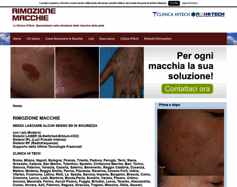 Rimozione-macchie.it thumbnail