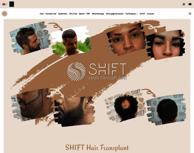 Shifthairtransplant.com thumbnail