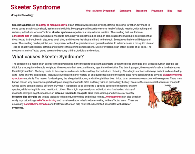 Skeetersyndrome.net thumbnail