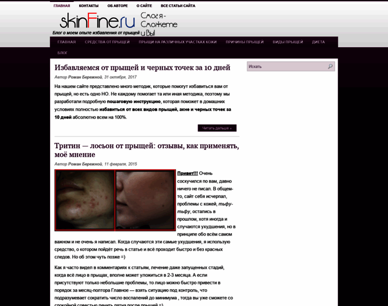 Skinfine.ru thumbnail