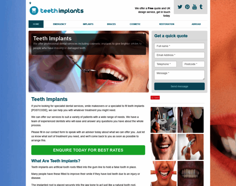 Teeth-implants.co.uk thumbnail