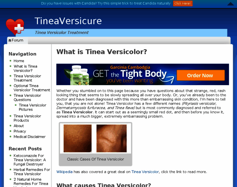 Tineaversicure.com thumbnail