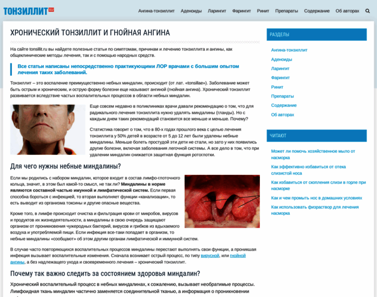 Tonsillit.ru thumbnail