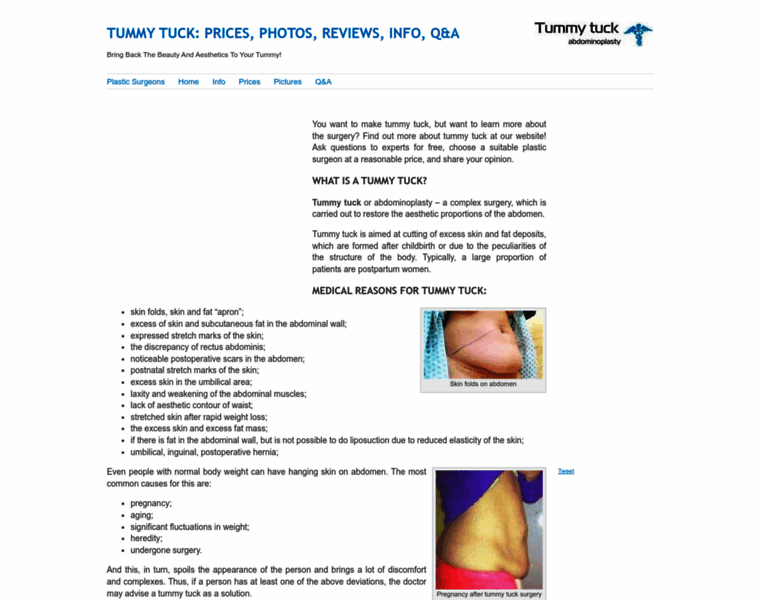 Tummy-tuck-abdominoplasty.com thumbnail
