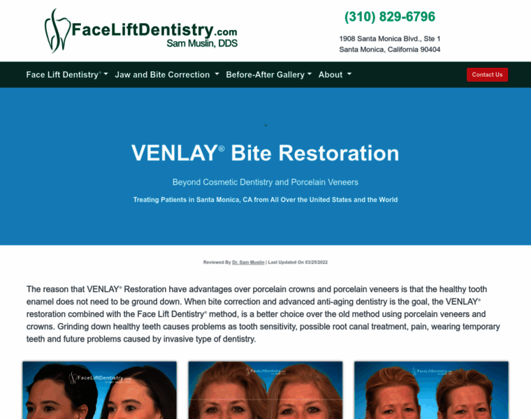 Venlay.com thumbnail
