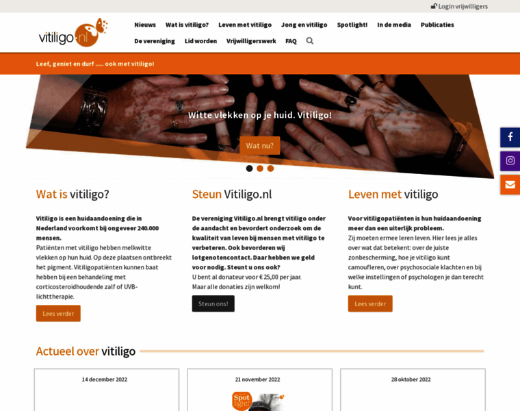 Vitiligo.nl thumbnail