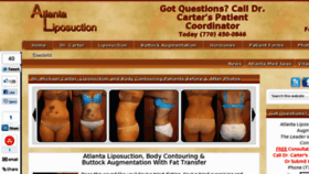 What Atlanta-liposuction.com website looked like in 2012 (11 years ago)