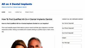 What All-on-4-dentalimplants.com website looked like in 2017 (6 years ago)