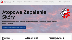 What Atopowe-zapalenie.pl website looked like in 2018 (5 years ago)