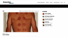 What Akupunktur-laegehuset.dk website looked like in 2019 (4 years ago)